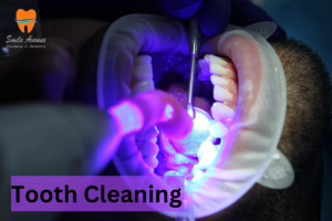tooth cleaning