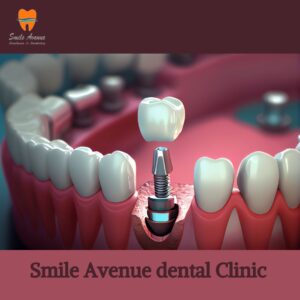 Smile Avenue dental clinic